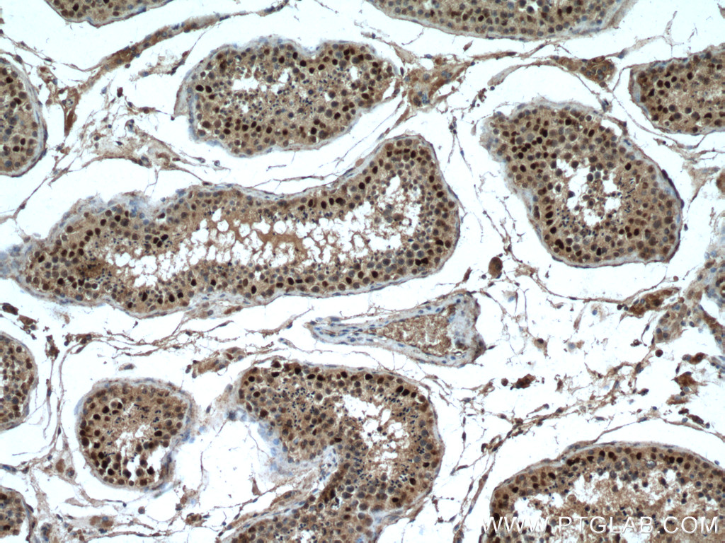 IHC staining of human testis using 27707-1-AP