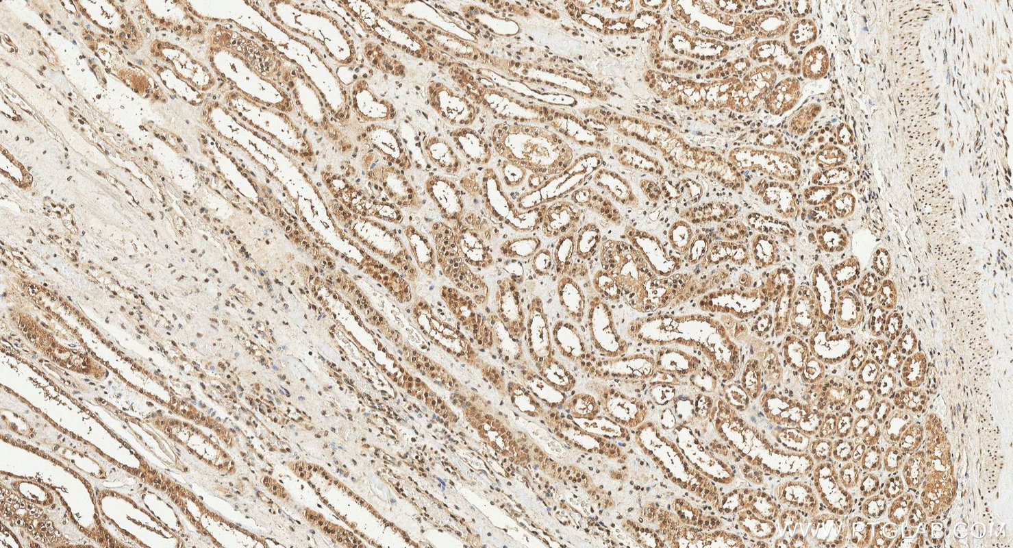 IHC staining of human kidney using 24864-1-AP (same clone as 24864-1-PBS)