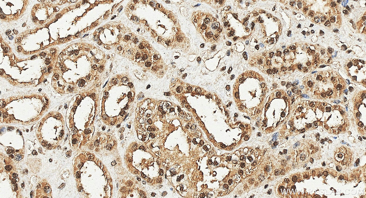 IHC staining of human kidney using 24864-1-AP (same clone as 24864-1-PBS)