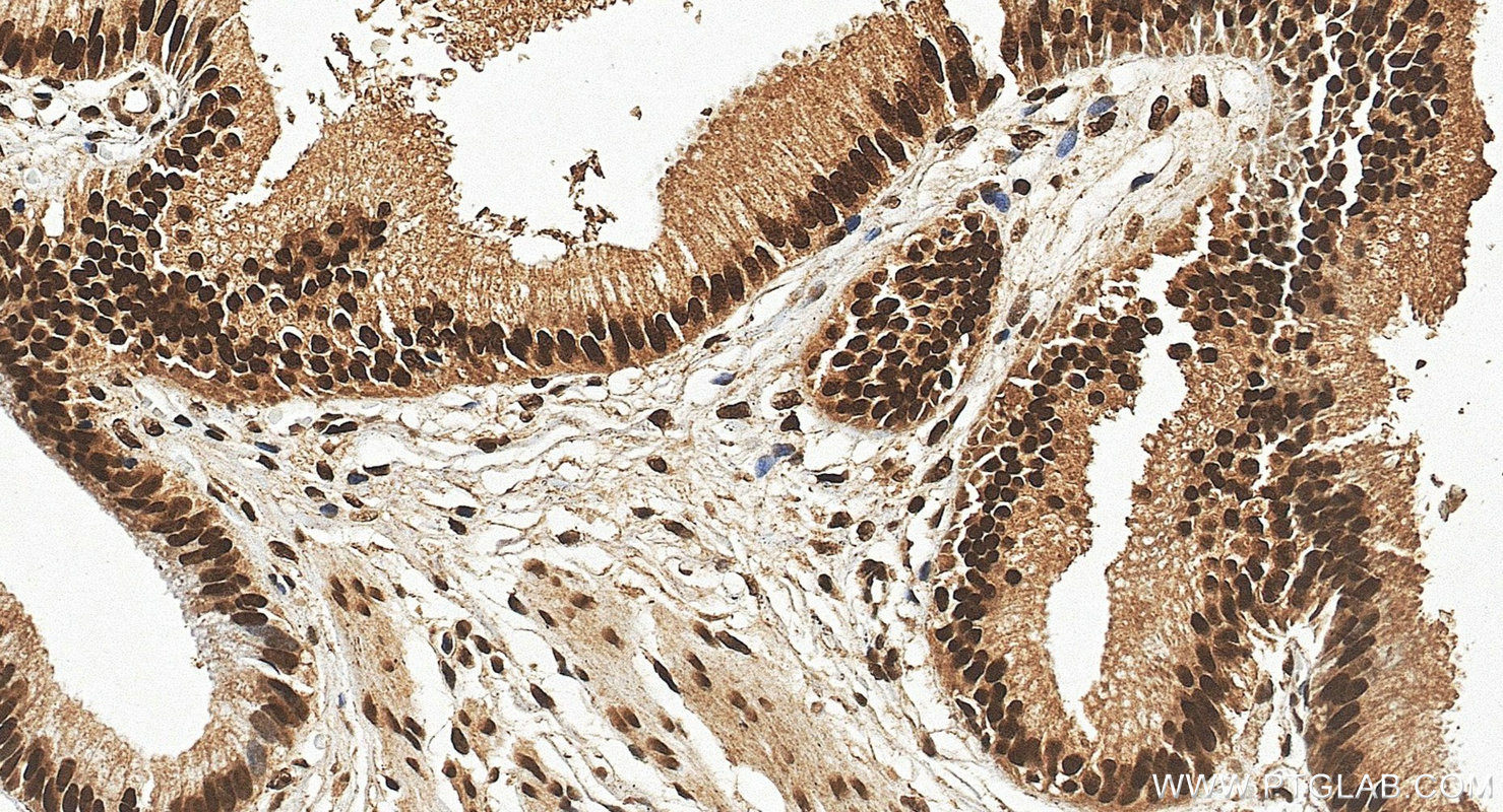 IHC staining of human bladder using 24864-1-AP (same clone as 24864-1-PBS)