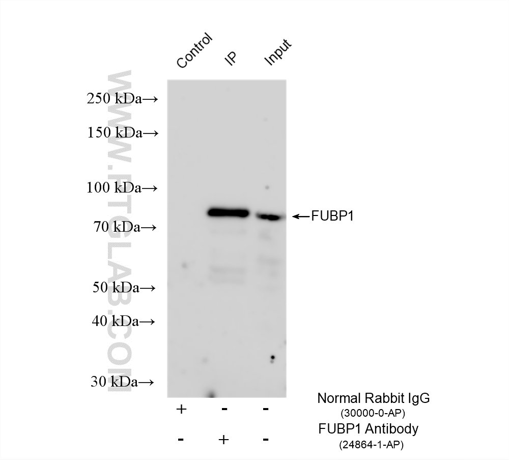 IP result of anti-FUBP1 (IP:24864-1-AP, 4ug; Detection:24864-1-AP 1:3000) with SH-SY5Y cells lysate 1480 ug. IP experiment of SH-SY5Y using 24864-1-AP