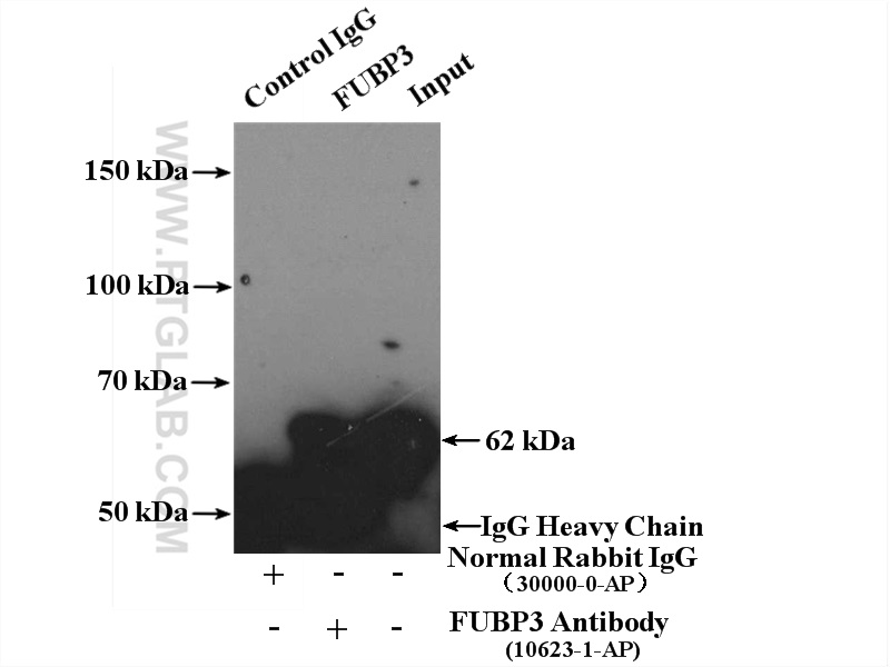 IP experiment of HEK-293 using 10623-1-AP