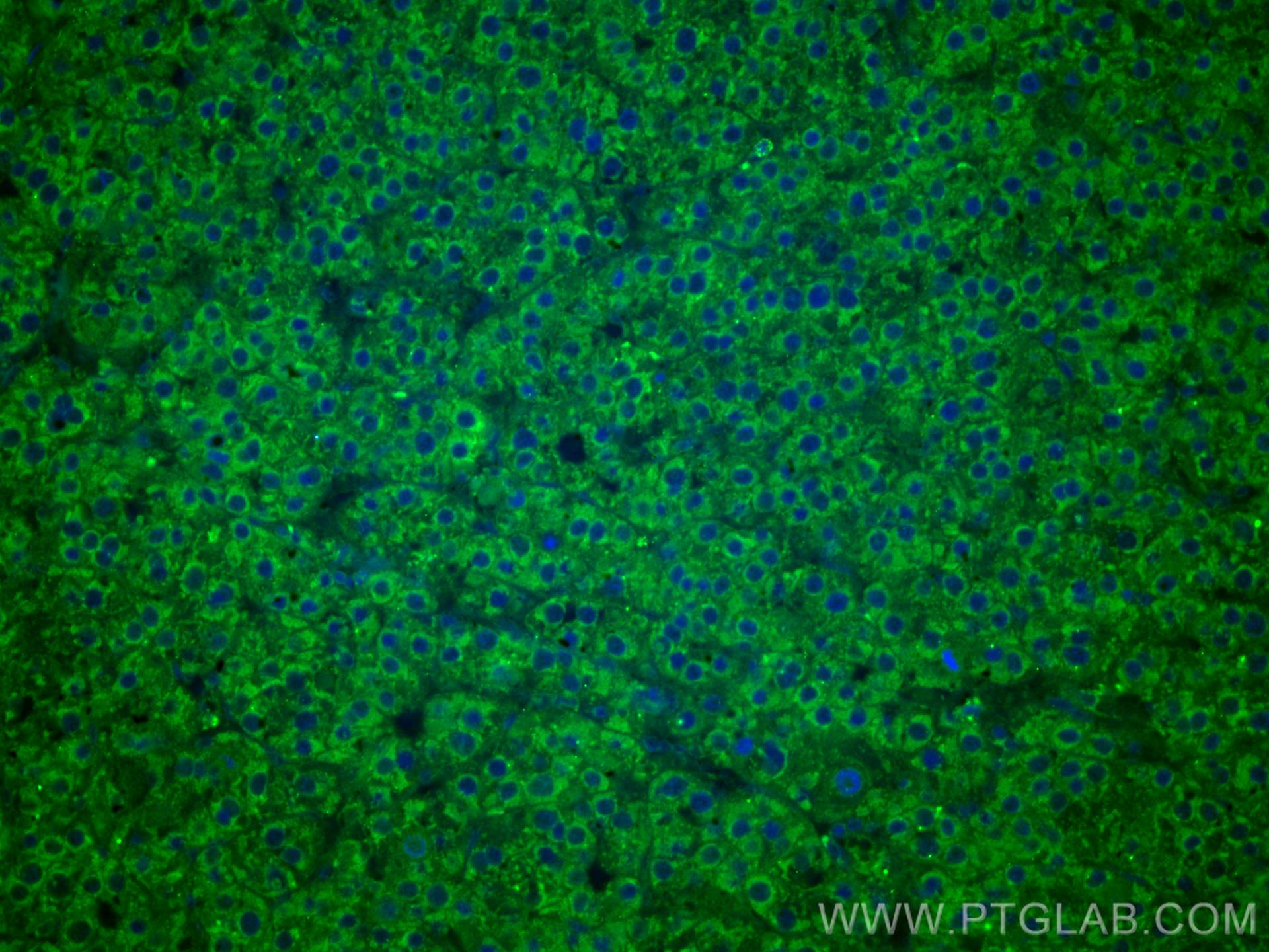 IF Staining of human liver cancer using CL488-67251