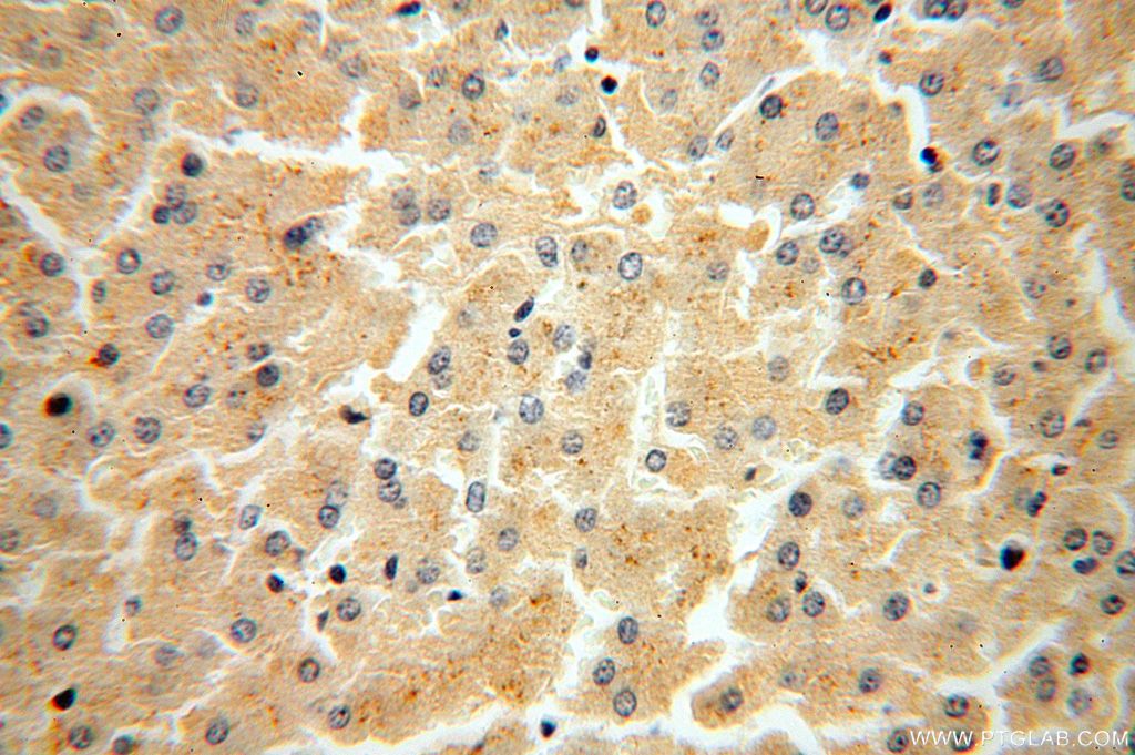 IHC staining of human liver using 15157-1-AP