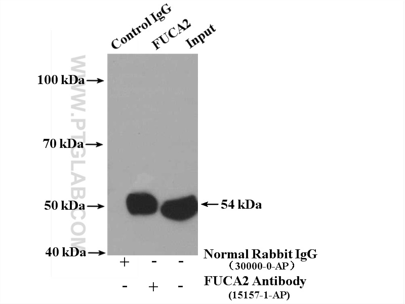 IP experiment of mouse heart using 15157-1-AP