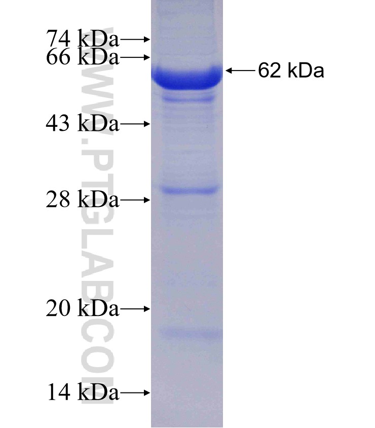 FUK fusion protein Ag4481 SDS-PAGE