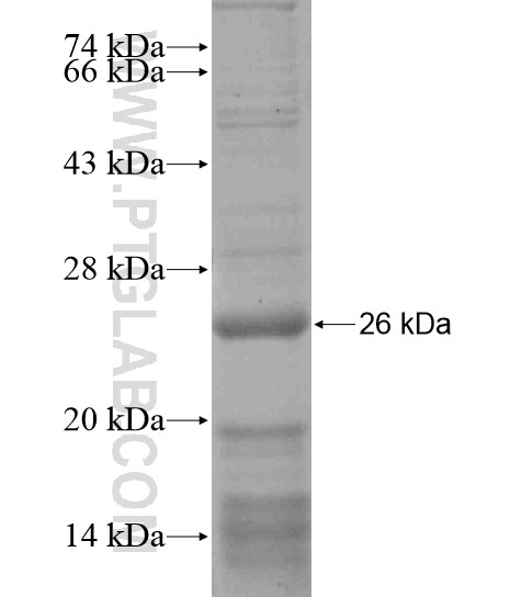 FUNDC1 fusion protein Ag18600 SDS-PAGE FUNDC1 fusion protein Ag18600 SDS-PAGE