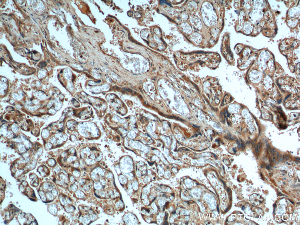 IHC staining of human placenta using 18413-1-AP