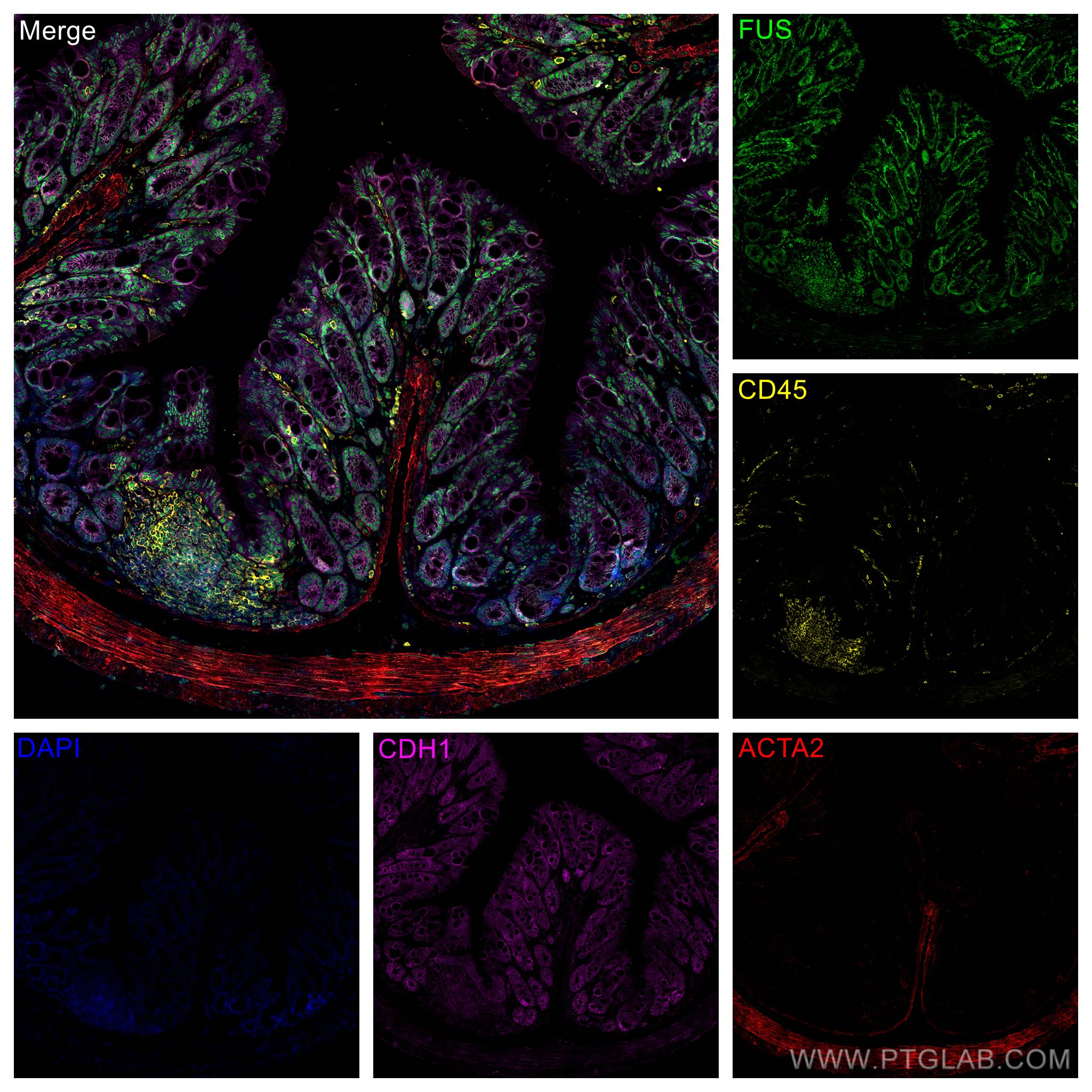 IF Staining of mouse colon using 11570-1-AP