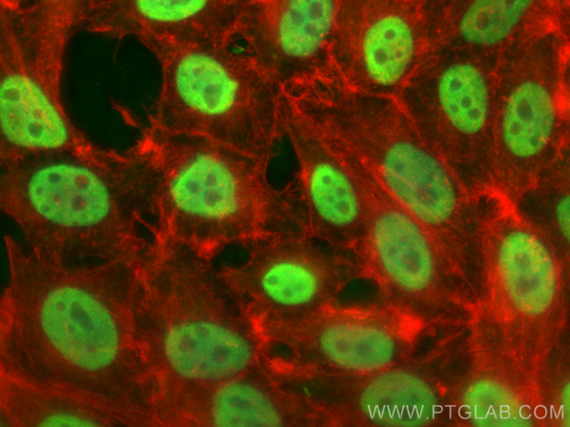 IF Staining of HepG2 using 11570-1-AP