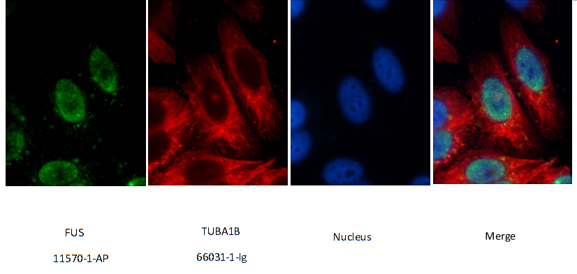 FUS/TLS Polyclonal antibody