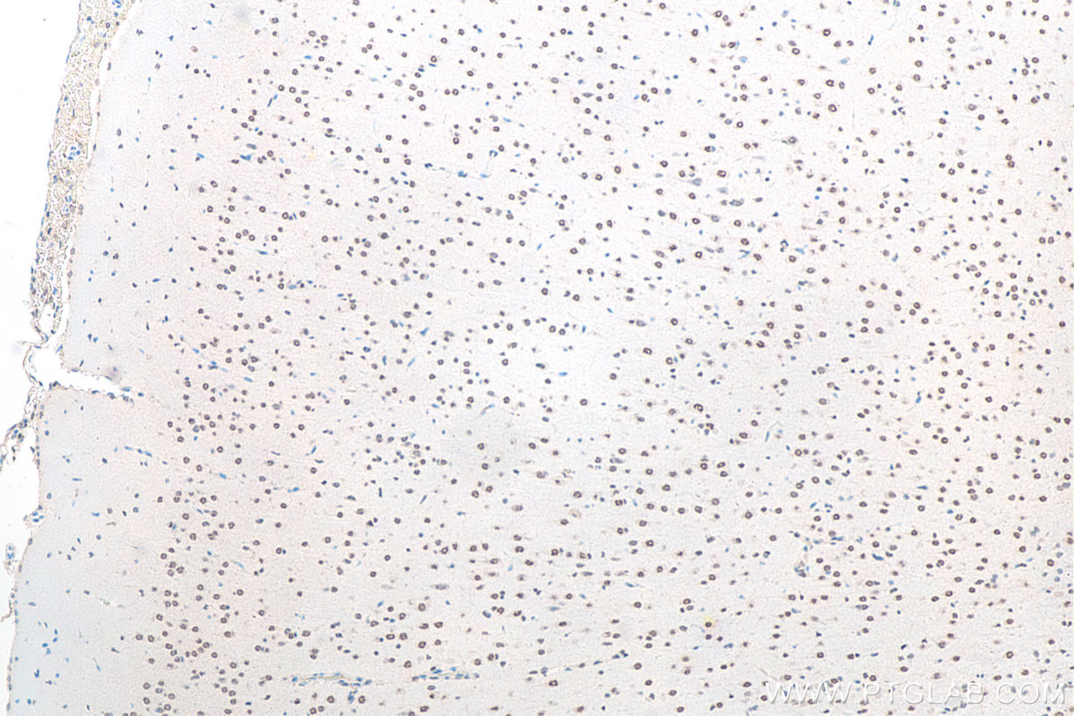 IHC staining of rat brain using 11570-1-AP IHC staining of rat brain using 11570-1-AP