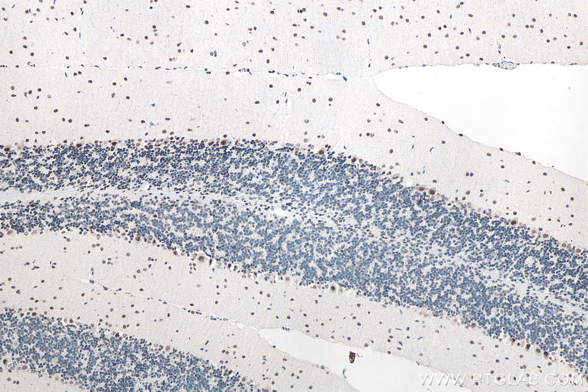 IHC staining of mouse cerebellum using 11570-1-AP IHC staining of mouse cerebellum using 11570-1-AP