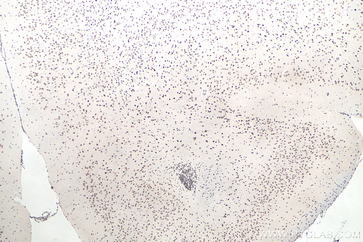 IHC staining of mouse brain using 11570-1-AP IHC staining of mouse brain using 11570-1-AP