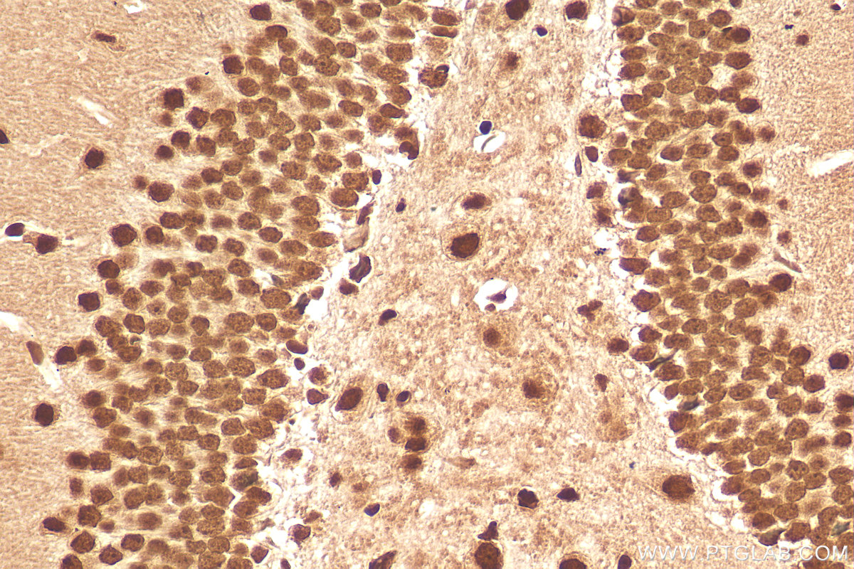 IHC staining of mouse brain using 11570-1-AP