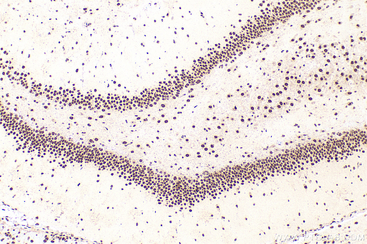 IHC staining of rat brain using 11570-1-AP IHC staining of rat brain using 11570-1-AP