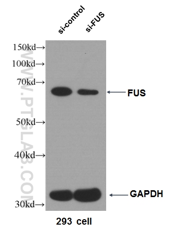 FUS/TLS Polyclonal antibody