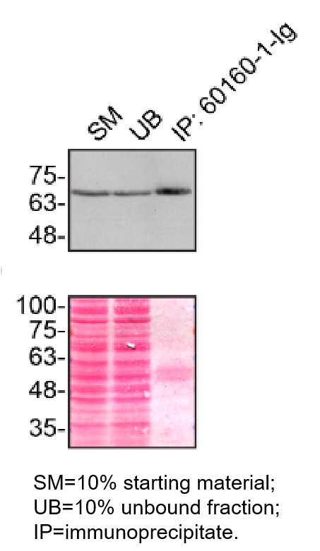 IP experiment of HeLa using 60160-1-Ig