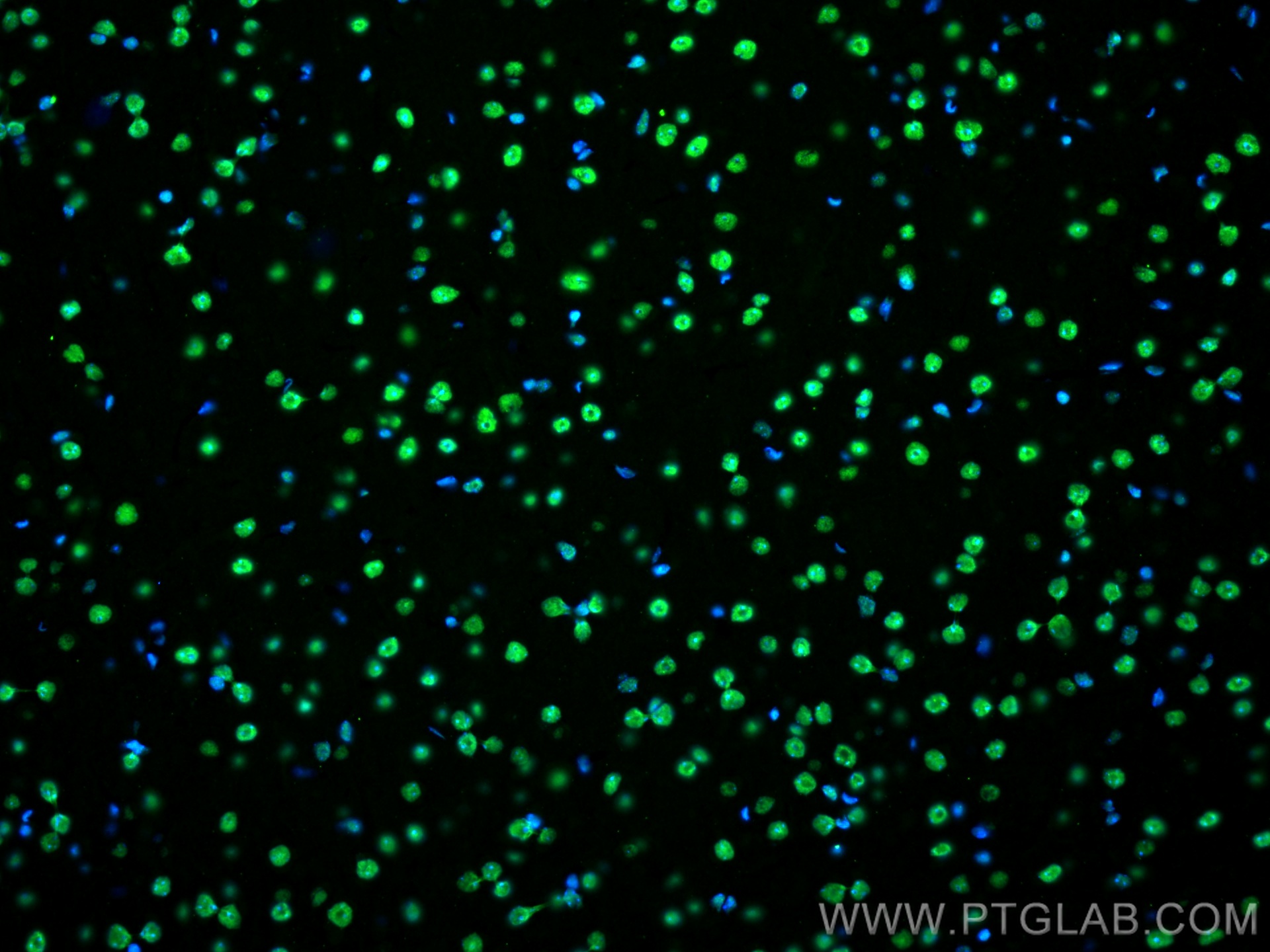 IF Staining of mouse brain using 68262-1-Ig (same clone as 68262-1-PBS)