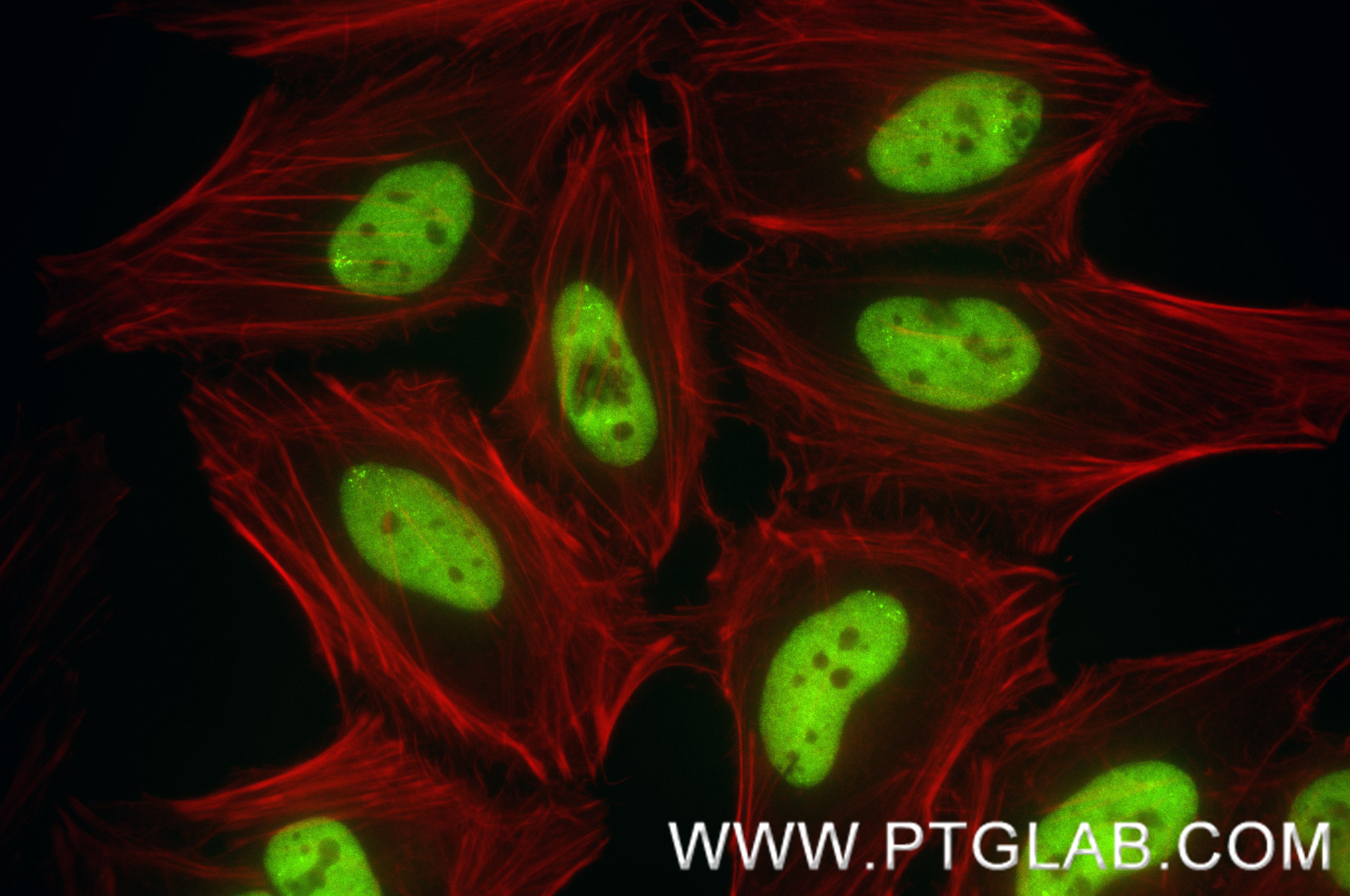 IF Staining of HeLa using 87839-1-RR IF Staining of HeLa using 87839-1-RR