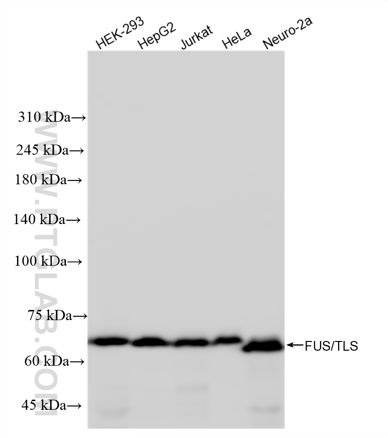 WB analysis using 87839-1-RR WB analysis using 87839-1-RR