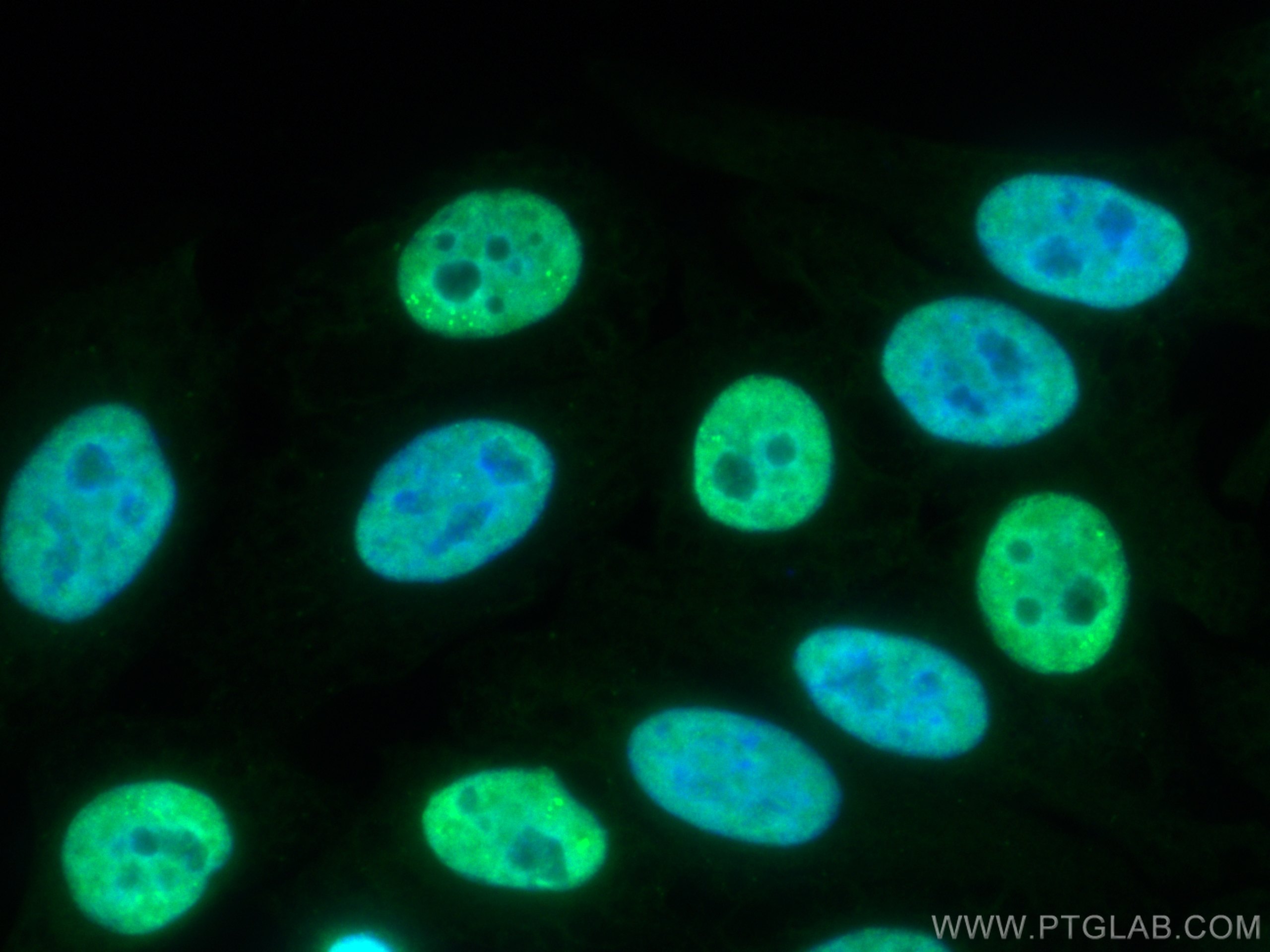 IF Staining of HepG2 using CL488-11570