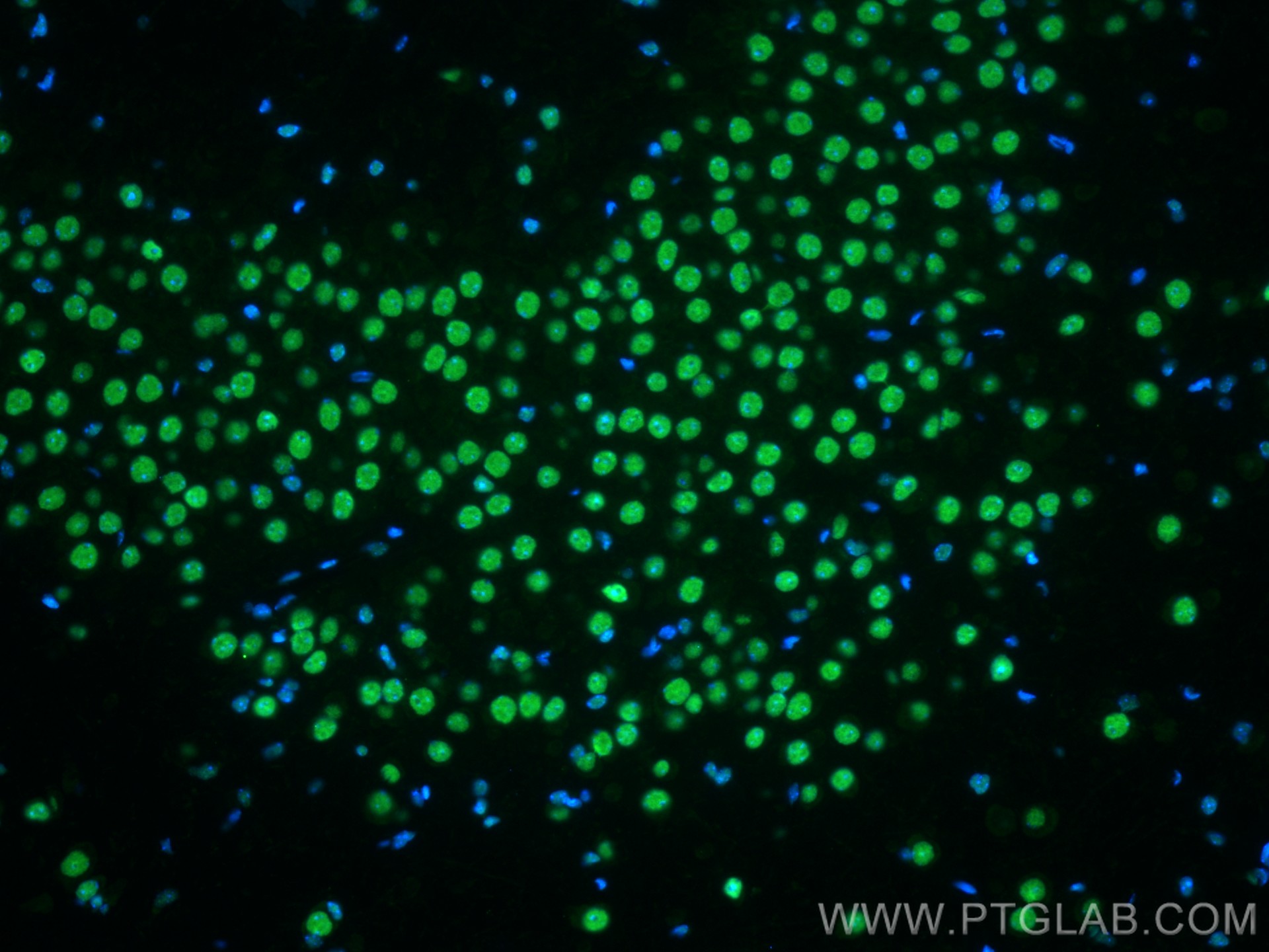 IF Staining of mouse brain using CL488-68262