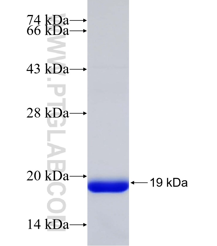 FUT1 fusion protein Ag33016 SDS-PAGE FUT1 fusion protein Ag33016 SDS-PAGE