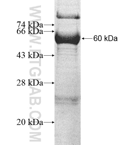 FUT11 fusion protein Ag10815 SDS-PAGE