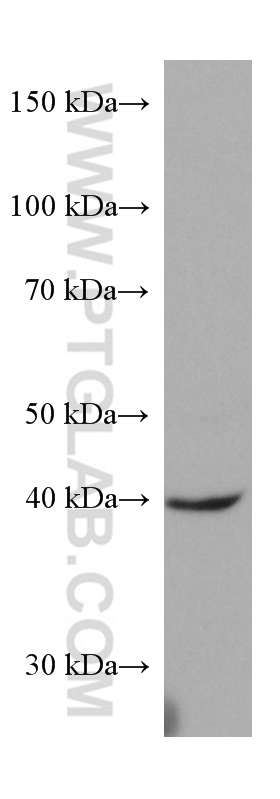 WB analysis of human placenta using 67344-1-Ig