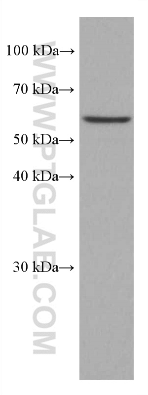 WB analysis of MDA-MB-231 using 66118-1-Ig (same clone as 66118-1-PBS)