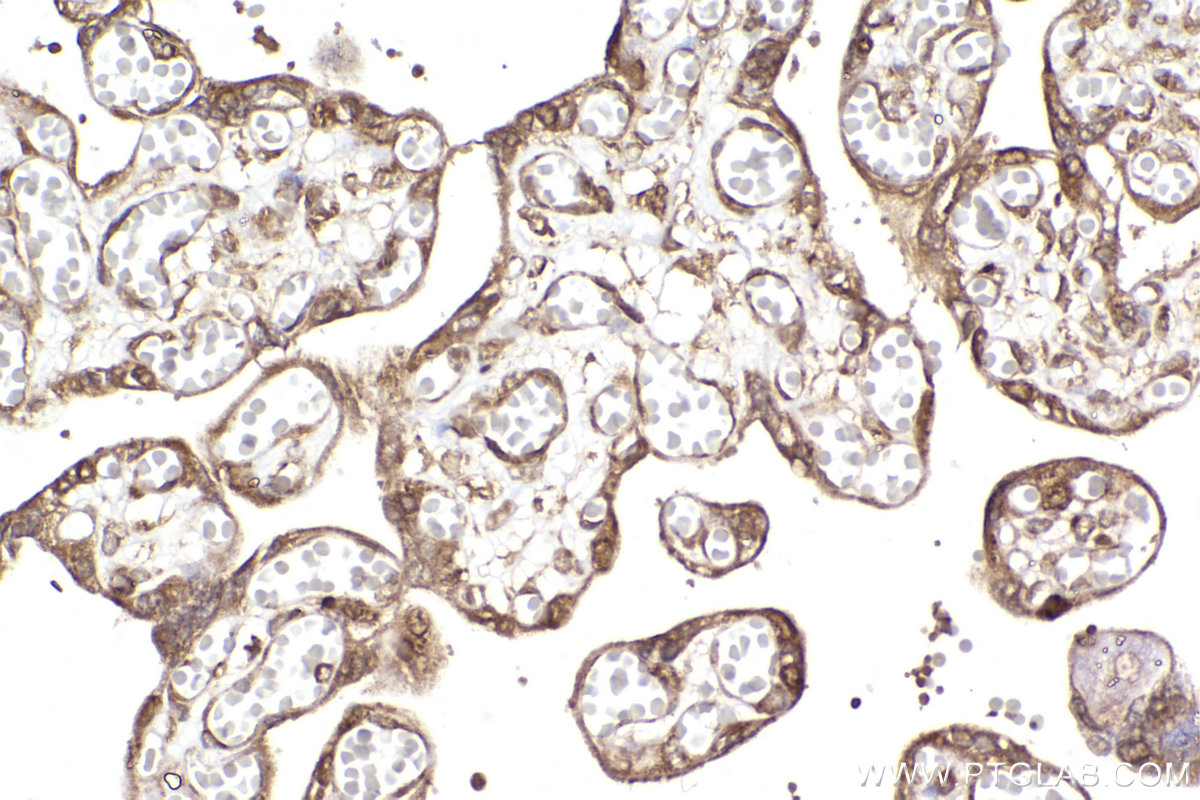 IHC staining of human placenta using 13194-1-AP (same clone as 13194-1-PBS)