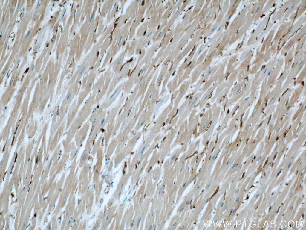 IHC staining of human heart using 13194-1-AP