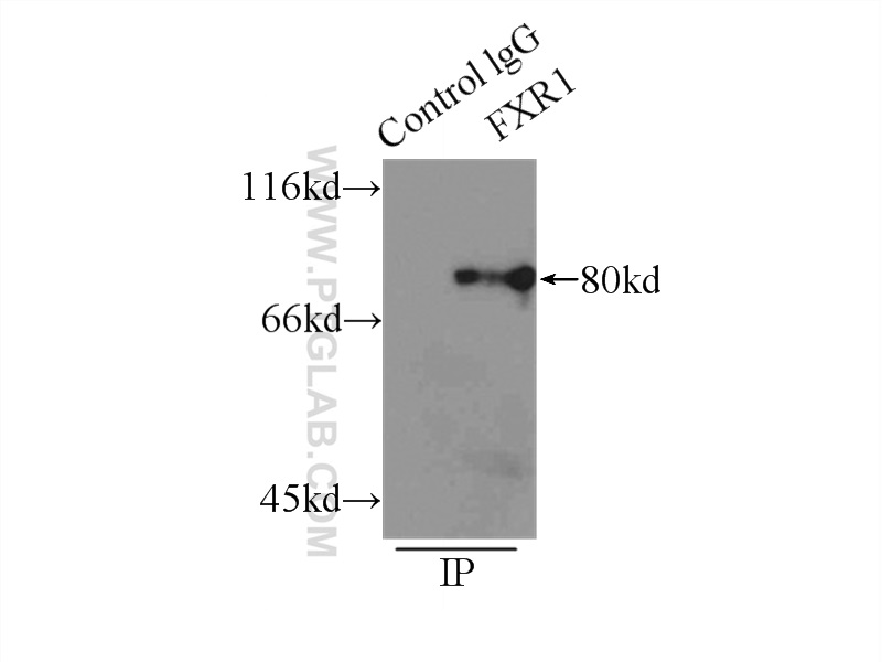 IP experiment of mouse skeletal muscle using 13194-1-AP