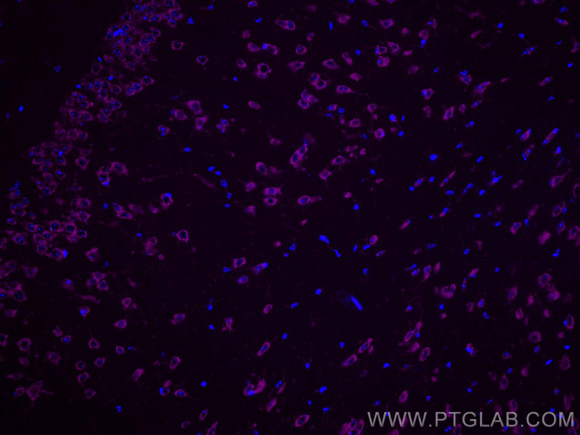 IF Staining of mouse brain using CL647-67813