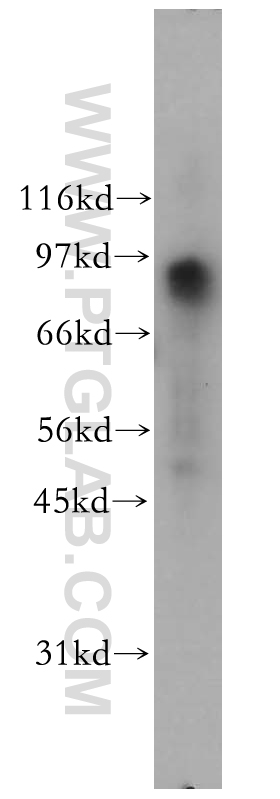 WB analysis of HeLa using 12552-1-AP