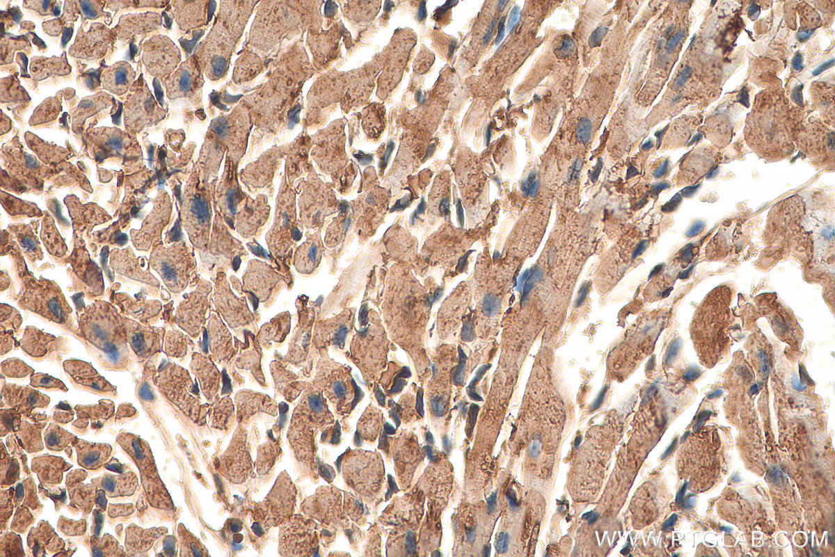 IHC staining of mouse heart using 13721-1-AP
