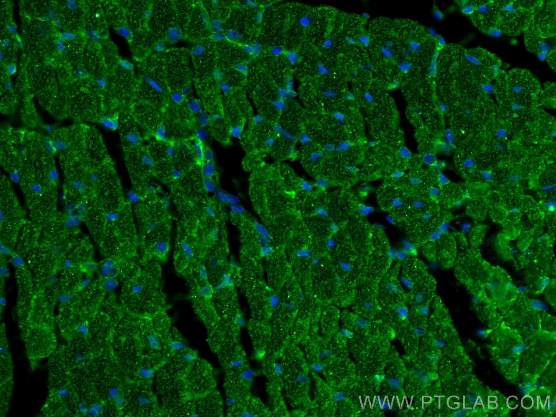 IF Staining of mouse heart using 67150-1-Ig