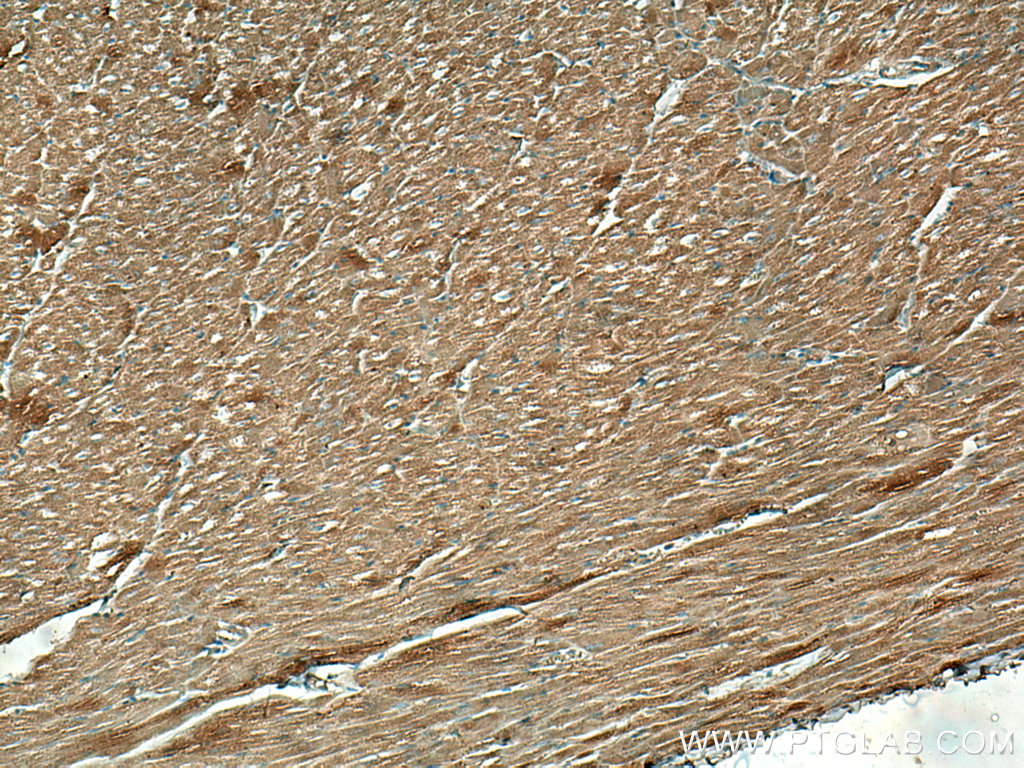 IHC staining of human heart using 67150-1-Ig