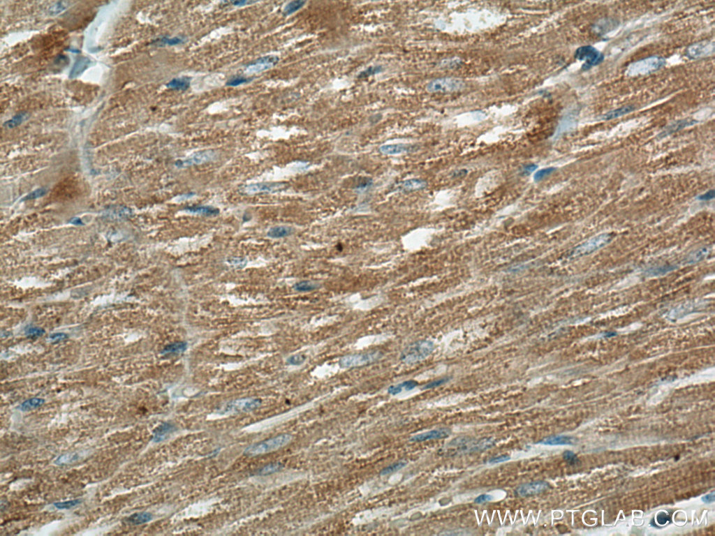 IHC staining of human heart using 67150-1-Ig