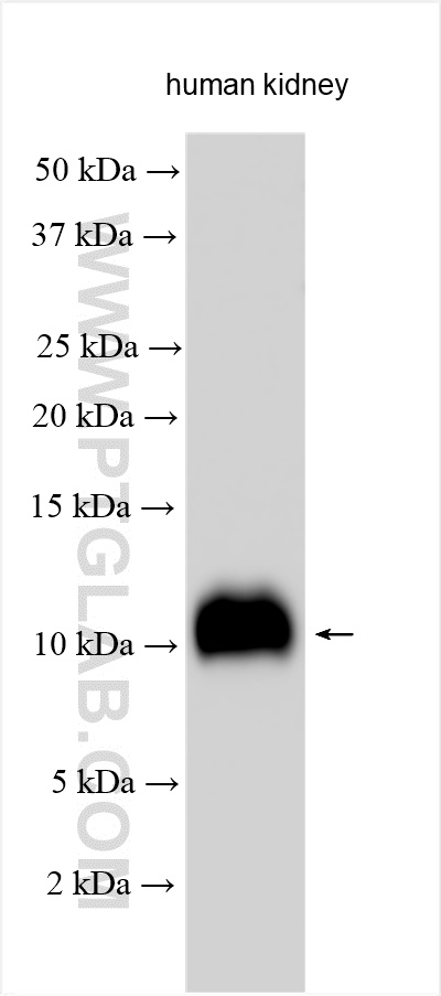 Various lysates were subjected to SDS PAGE followed by western blot with 11198-1-AP (FXYD2 antibody) at dilution of 1:2500 incubated at room temperature for 1.5 hours. WB analysis using 11198-1-AP