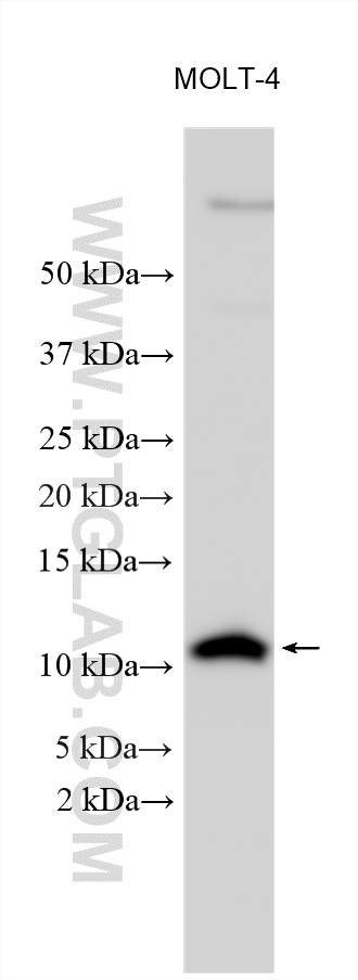 Various lysates were subjected to SDS PAGE followed by western blot with 11198-1-AP (FXYD2 antibody) at dilution of 1:1000 incubated at room temperature for 1.5 hours. WB analysis using 11198-1-AP