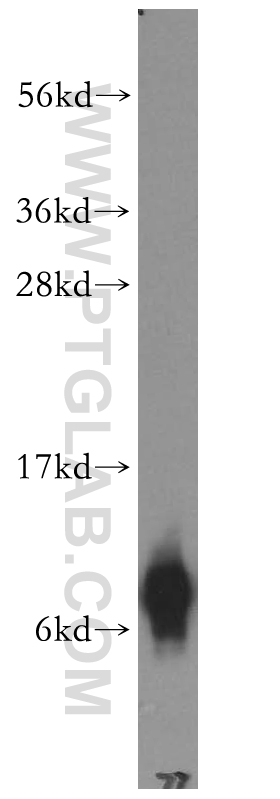 WB analysis of COLO 320 using 15853-1-AP