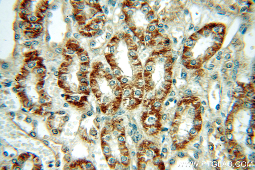 IHC staining of human kidney using 12166-1-AP