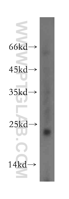 WB analysis of mouse small intestine using 12166-1-AP