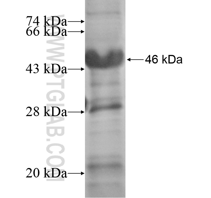 FXYD5 fusion protein Ag14439 SDS-PAGE FXYD5 fusion protein Ag14439 SDS-PAGE