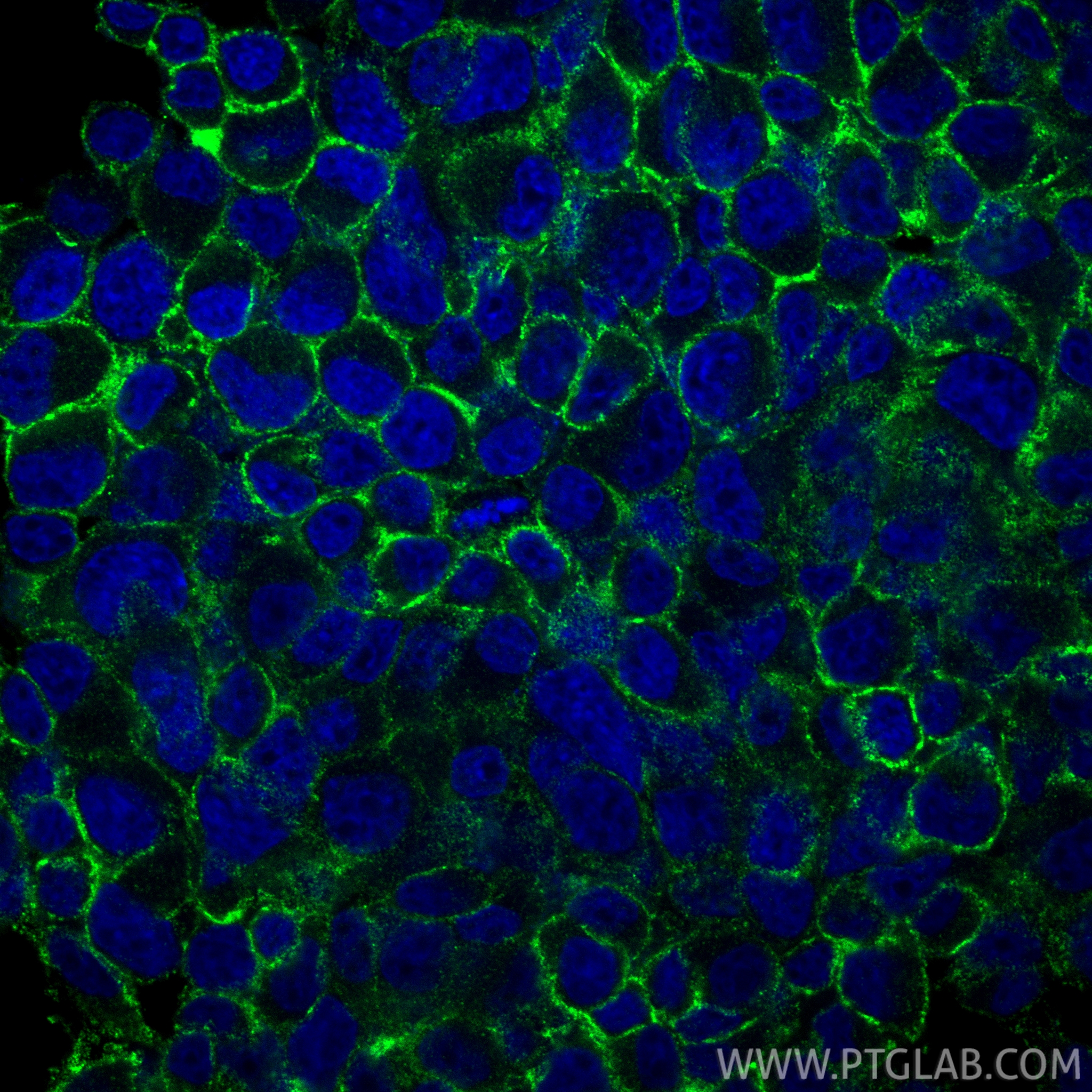 Immunofluorescent analysis of (4% PFA) fixed PC-12 cells using FXYD6 antibody (15805-1-AP) at dilution of 1:200 and CoraLite®488-Conjugated Goat Anti-Rabbit IgG(H+L) (<a class='green' href='/productredirect?CatalogNo=SA00013-2' target='_blank'>SA00013-2</a>). IF Staining of PC-12 using 15805-1-AP