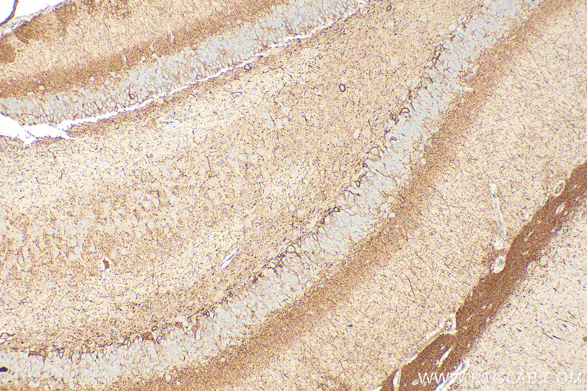 Immunohistochemical analysis of paraffin-embedded rat brain tissue slide using 15805-1-AP (FXYD6 antibody) at dilution of 1:200 (under 10x lens). Heat mediated antigen retrieval with Tris-EDTA buffer (pH 9.0). IHC staining of rat brain using 15805-1-AP