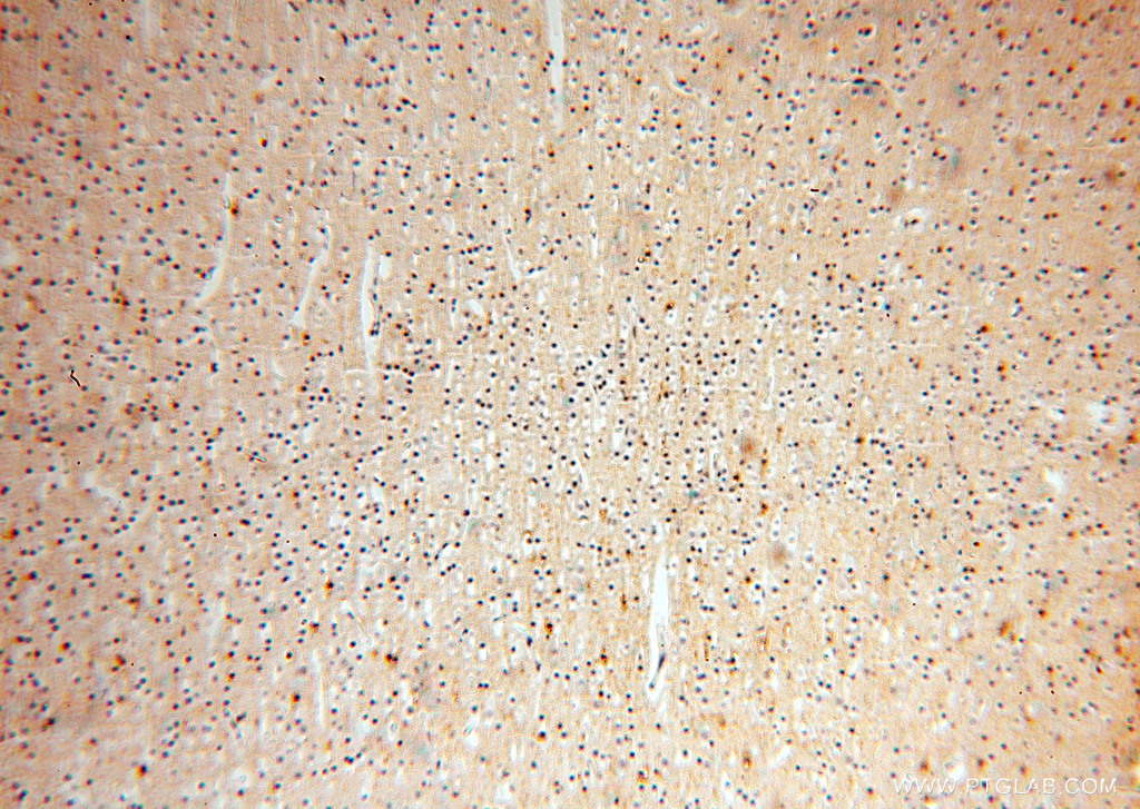 IHC staining of human brain using 15805-1-AP