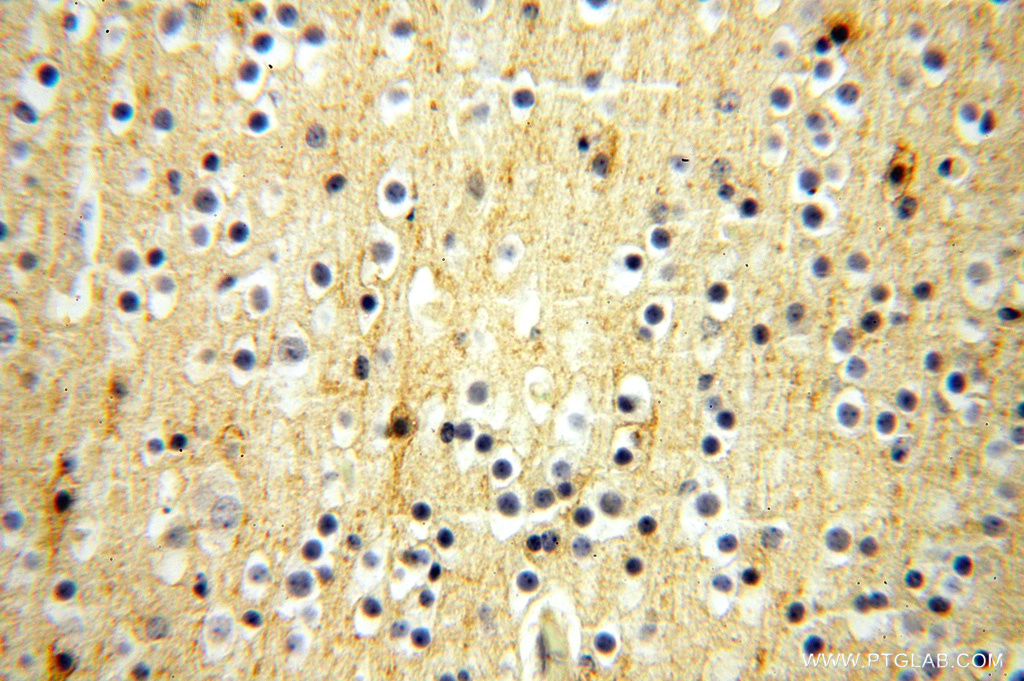 IHC staining of human brain using 15805-1-AP